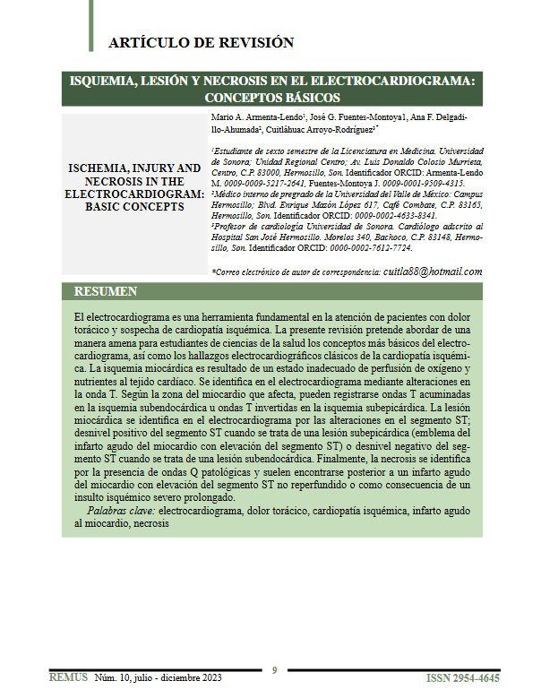 Portada del articulo de revisión: Isquemia. lesión y necrosis en el electrocardiograma, conceptos básicos